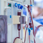 Hemodiálise na UTI: complicações mais comuns e como prevenir riscos no paciente crítico
